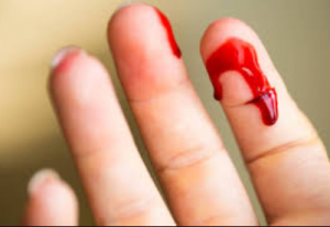 হাত কাটা ছবি পিকচার